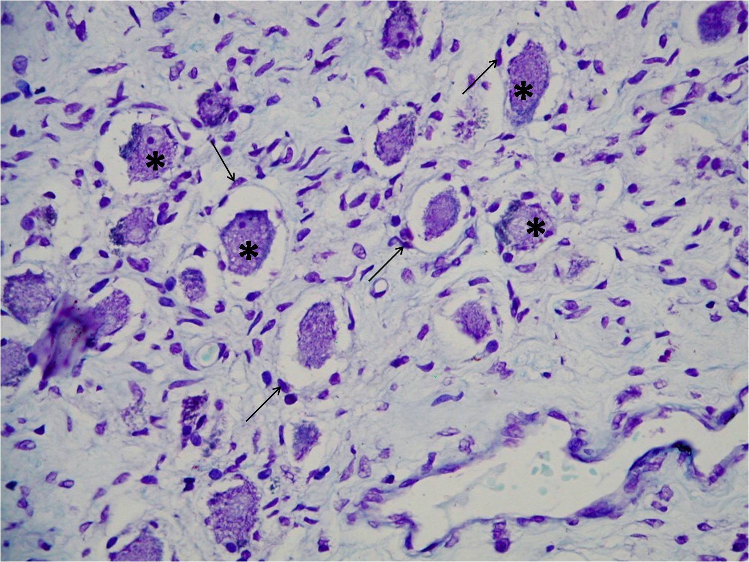 SOS BIOLOGIA CELULAR Y TISULAR: TEJIDO NERVIOSO
