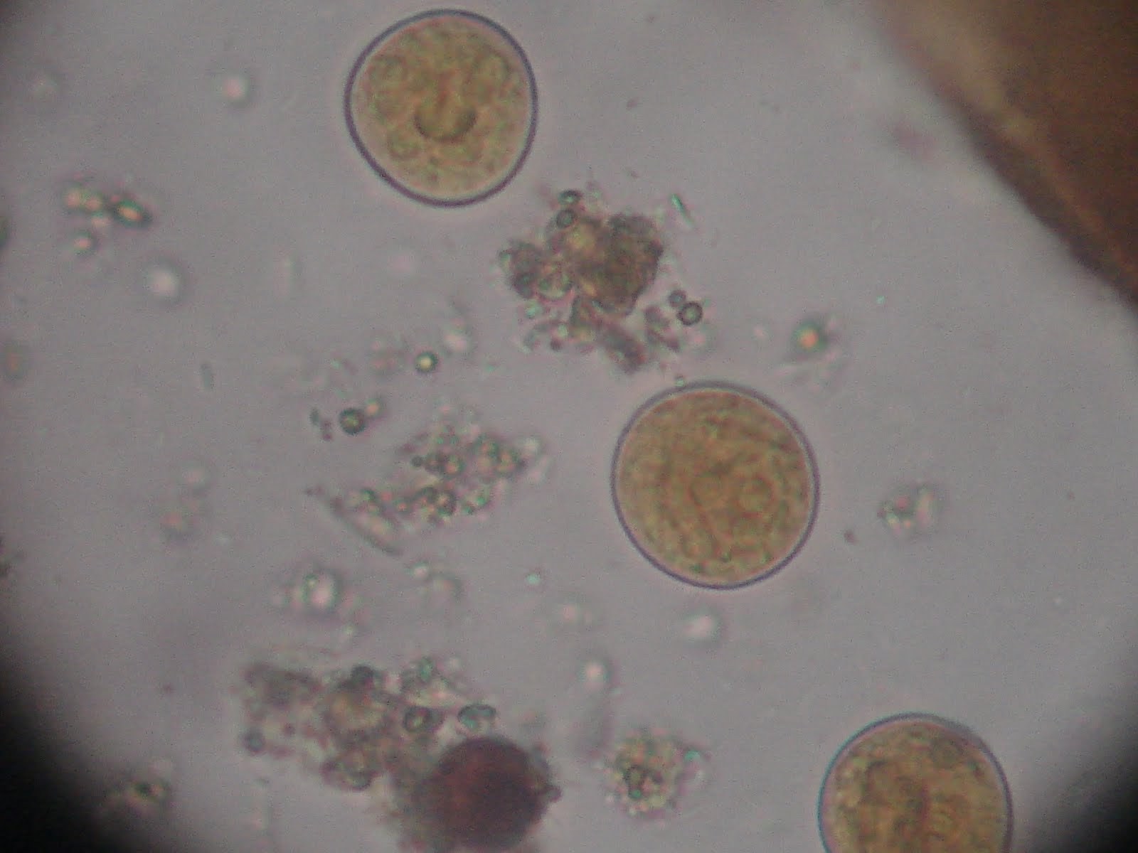 Entamoeba coli в кале. Цисты лямблии микроскопия. Цисты лямблий микроскопия кала. Циста лямблии под микроскопом.