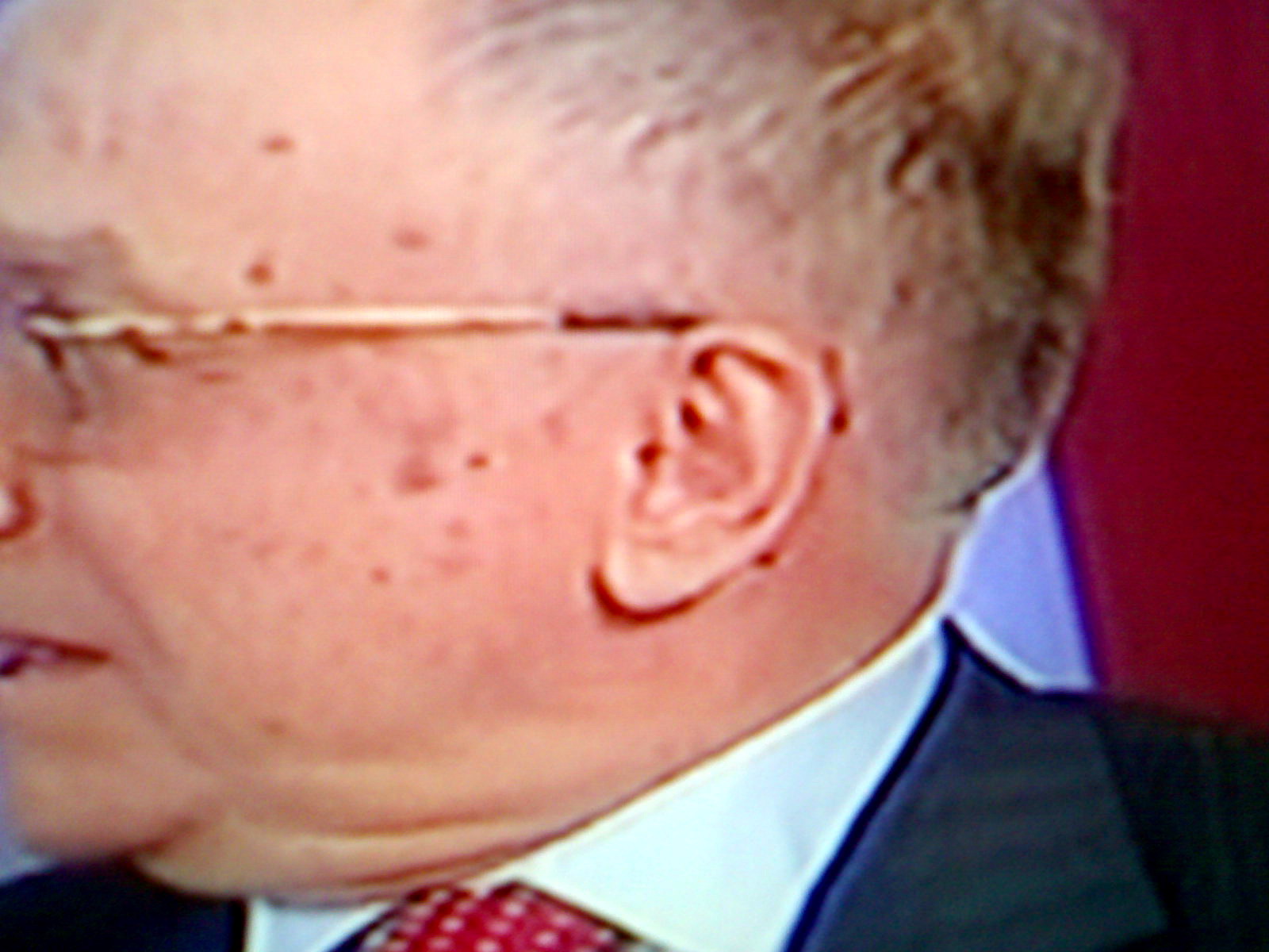 [Iliescu+plin+de+bube.jpg]