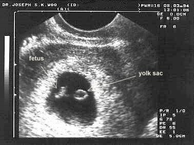 gebelikte hamilelikte ultrason ile yapilan olcumler