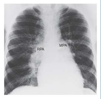 Cardiology secrets: All About Chest Radiographs