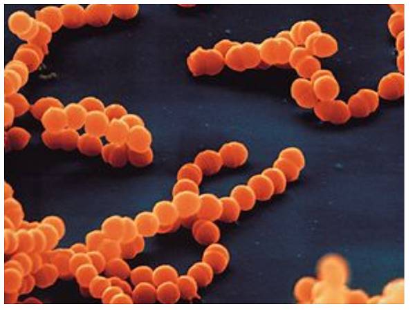 Picture Of Strep Throat Bacteria 95