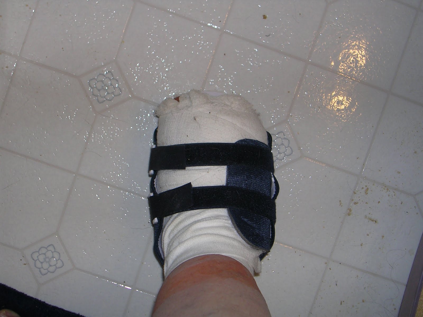 Quiltcat's Mewsings How to Take a Shower While Wearing a Surgical Boot