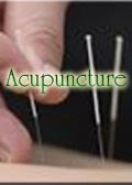 Acupuncture ( Akupuntur )