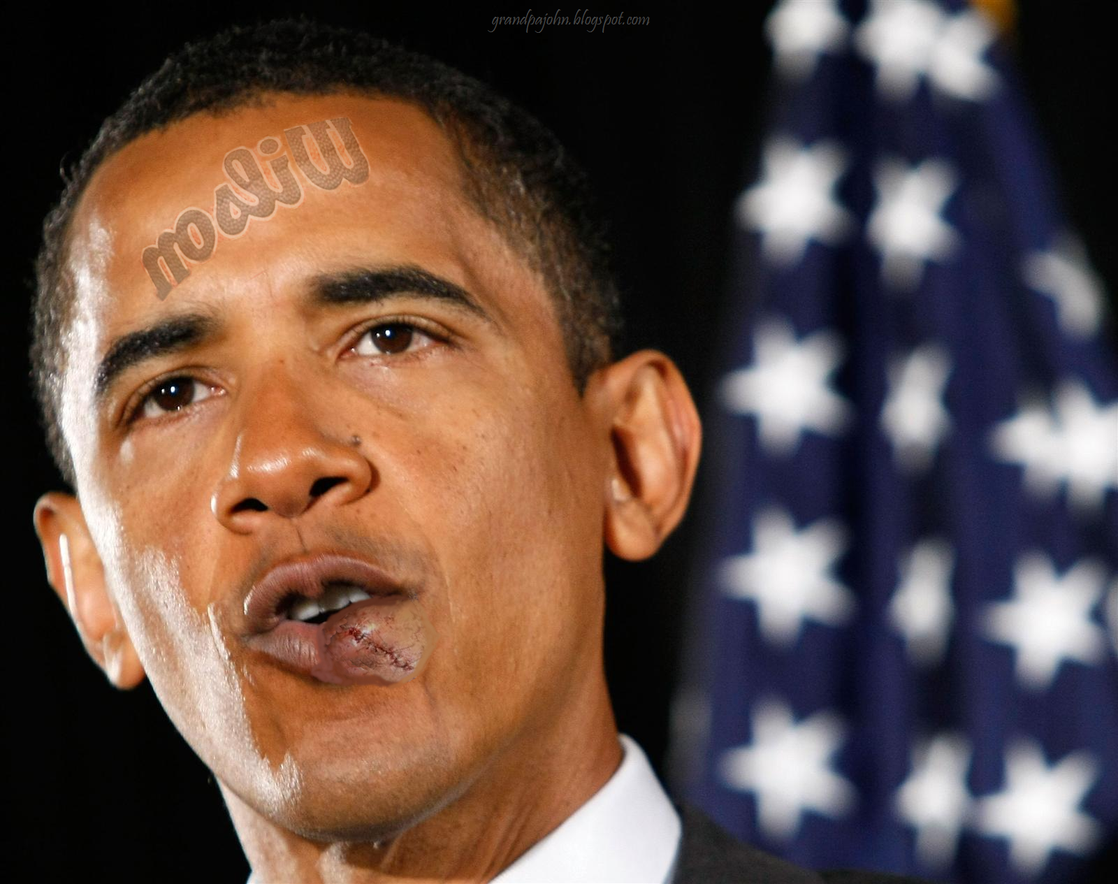 http://1.bp.blogspot.com/_sK6O7q1TURQ/TPBgxjrLeMI/AAAAAAAAEJU/_W_DZUASU84/s1600/Obama%2527s+Stitches.png