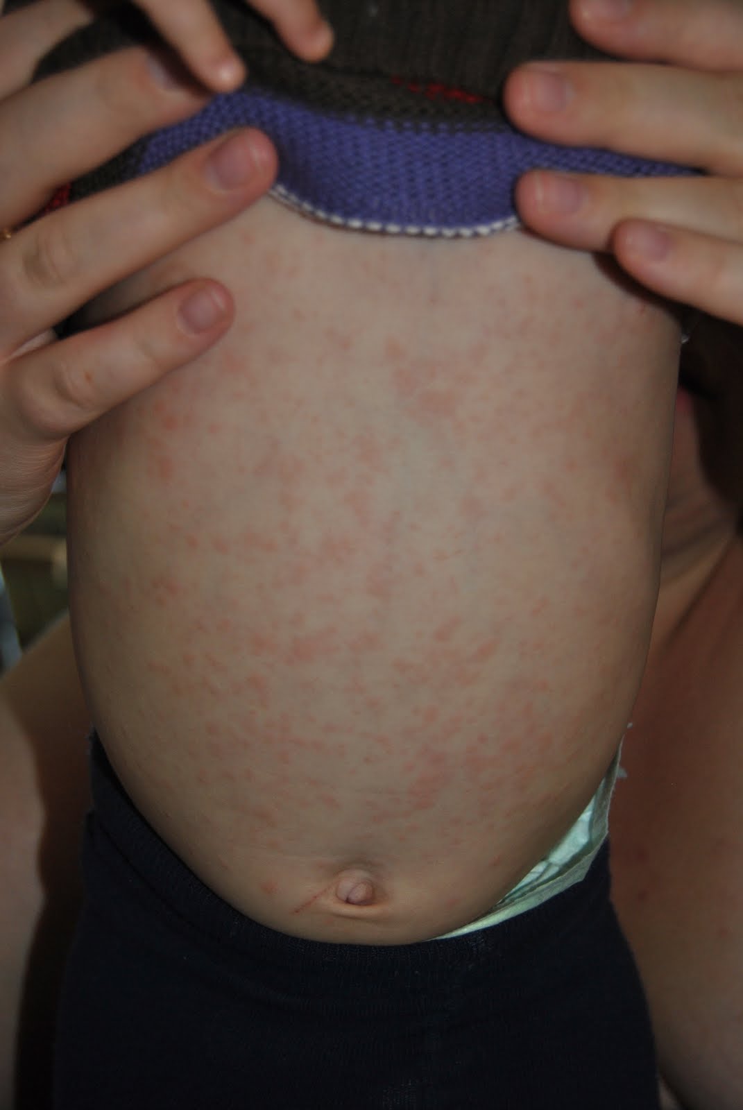 life-of-mlee-prick-it