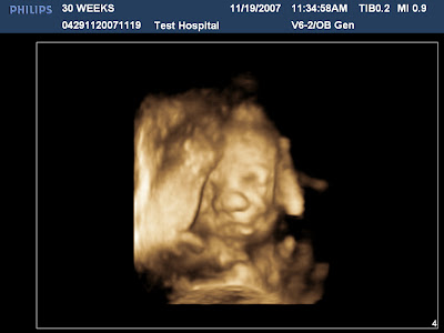 3d ultrasounds at 30 weeks 3d ultrasounds at 30 weeks