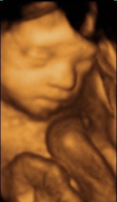 Mommy Mels: Twins&rsquo; 4d ultrasound