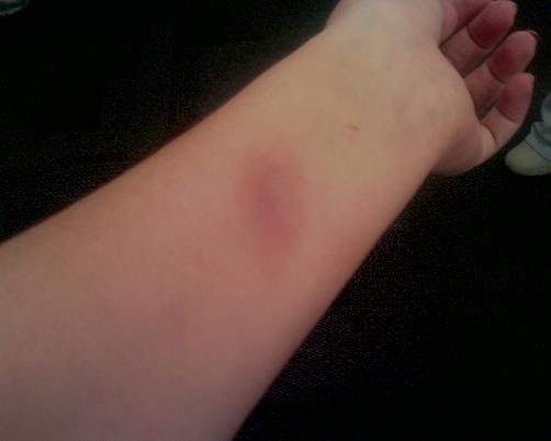 bre's makeup blog: Blackeye & Bruises