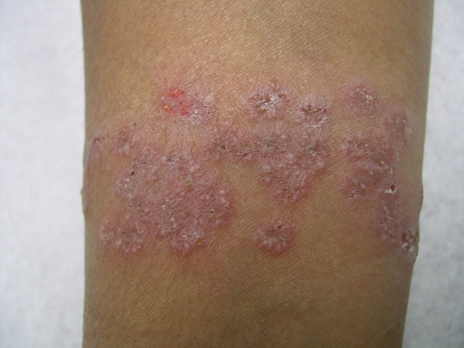 [temas_alerji[1].jpg]