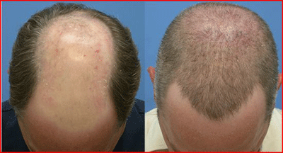 [sac_ekimi_clip_image002_0003[1].gif]