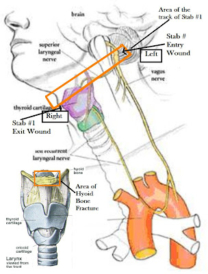 Seng Nduwe Ngamuk: vagus nerve diagram