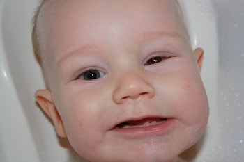 9 days post op - eating bubbles