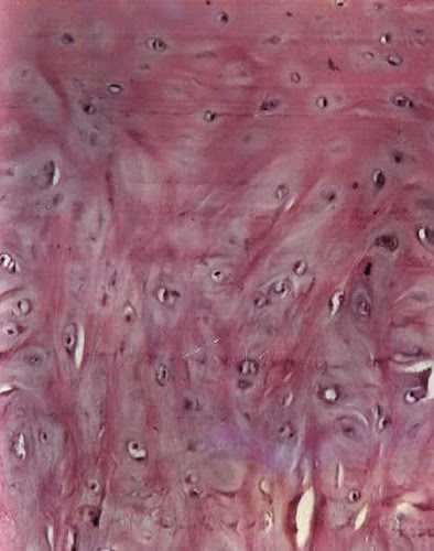 HISTOLOGIA: cartilago hialino