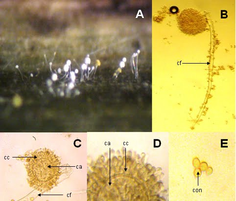 Aspergillózis (aspergillosis), Aspergillus gomba parazita