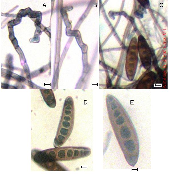 Helminthosporium halodes m8, Morfologi helminthosporium sp