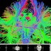 Diffusion Tensor Imaging 101