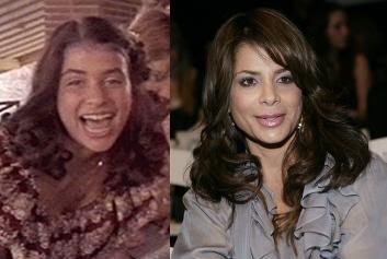 Before she was famous and after photos of Paula Abdul prove she is no stranger to plastic surgery