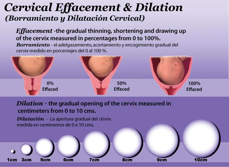 Centimeters Dilated Chart