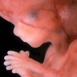 feto de 14 semanas