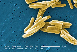 Mycobacterium tuberculosis - Photo credit: Janice Carr