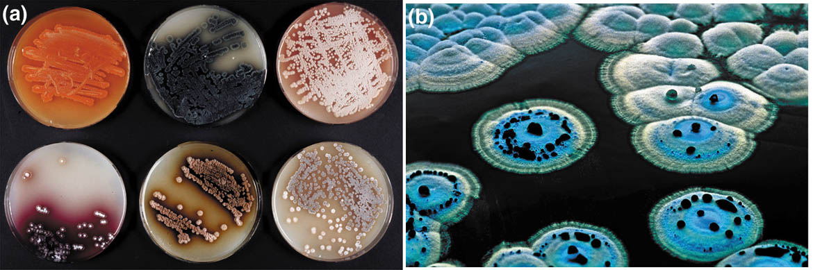 [Streptomyces+plates+and+colonies.jpg]