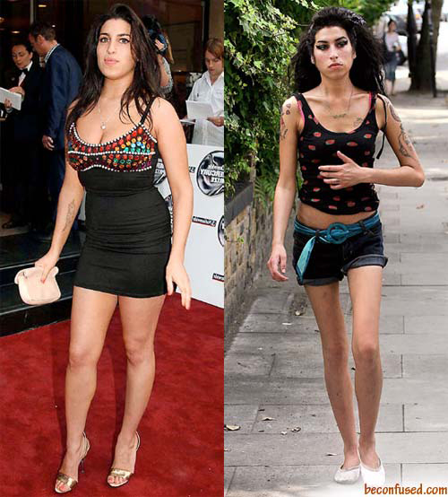 Resultado de imagen para Amy Winehouse Drogas antes despues