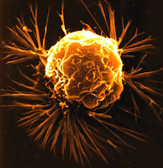 Deadly Childhood Cancer