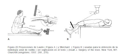 rodilla | notas de rehabilitación