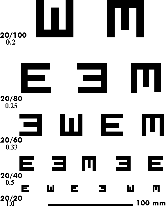 vision eye chart