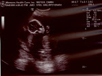 Baby Meyer