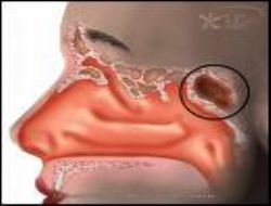 [geniz+akıntısı.jpg]