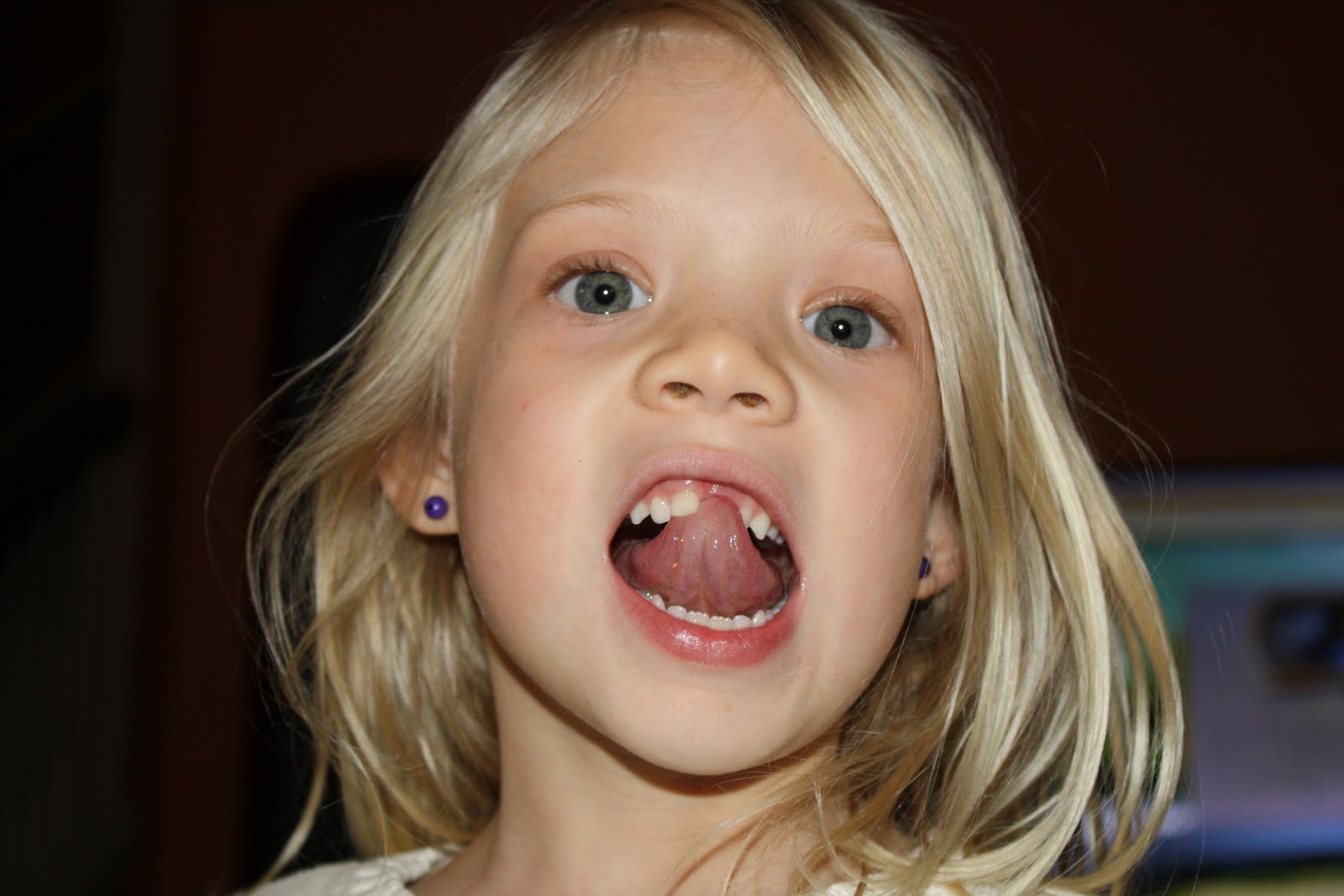 Imagebam orlow set. Девочка с открытым ртом. Дети с открытым ртом. Красивые девочки с открытым ртом. Маленькая девочка с открытым ртом.