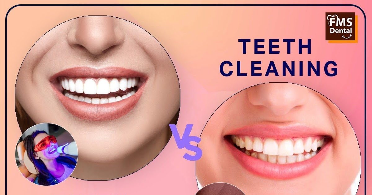 See The Difference Between Teeth Whitening and Teeth Cleaning