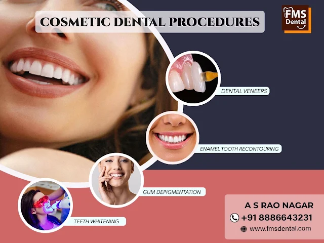 Smile Designing FMS Dental
