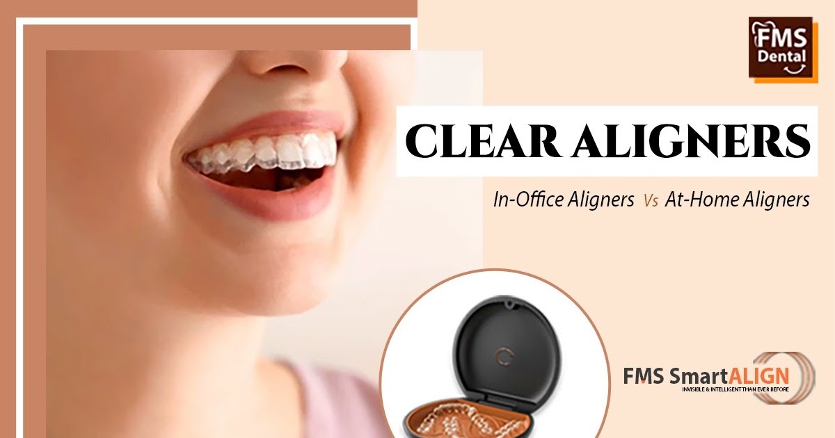 Office Aligners Vs At-Home Aligners