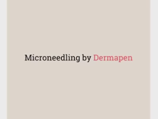 Microneedling in Brooklyn