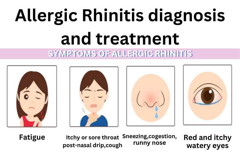 Allergic Rhinitis diagnosis and treatment 10 Ana Blog