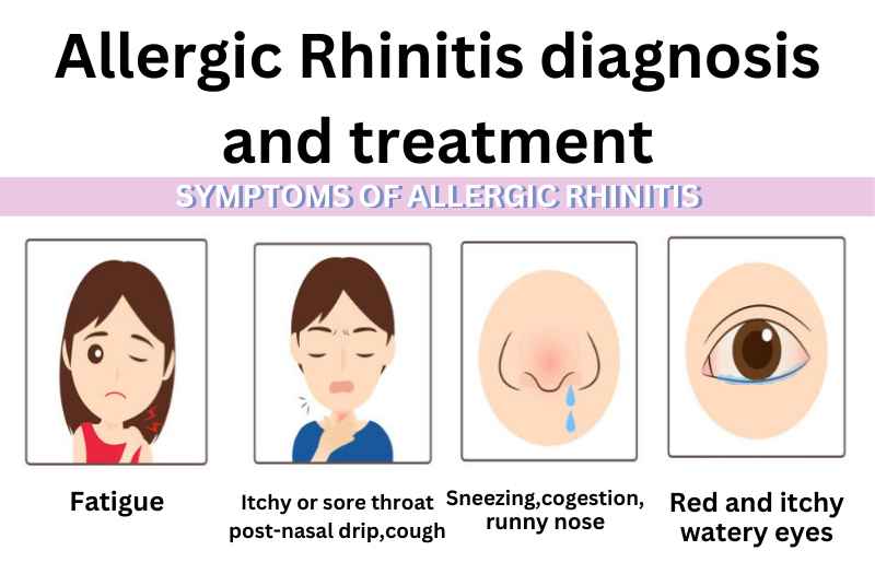 Symptoms of Allergic Rhinitis