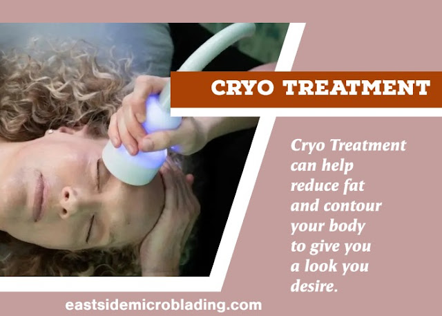 Cryo Treatment