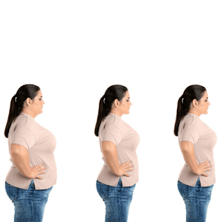 How to cure PCOS symptoms